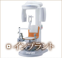 インプラント